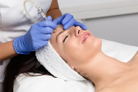 SkinPen® Microneedling